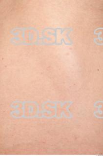 Skin texture of Gene 0002